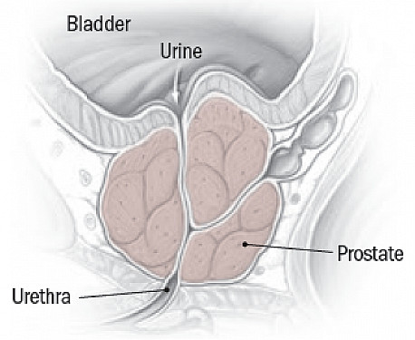Where Is The Prostate? Diseases Of The Prostate In Men